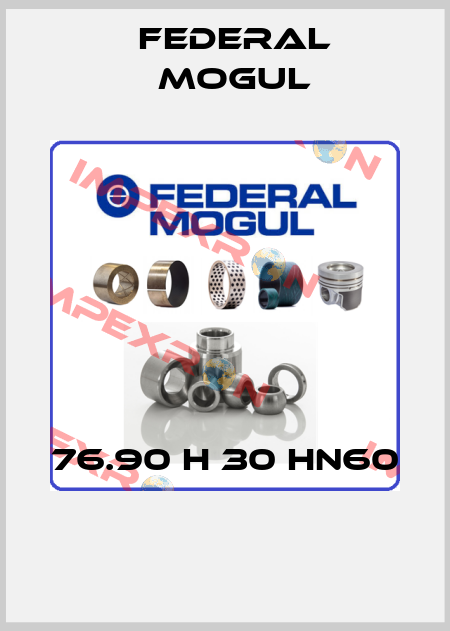 76.90 H 30 HN60       Federal Mogul